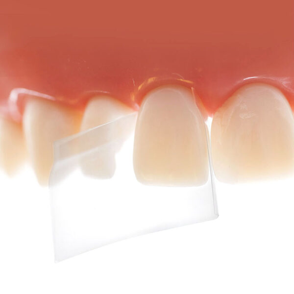 ProxyPal 3D Anterior Matrix | Dentistry Products | Fibrebond.
